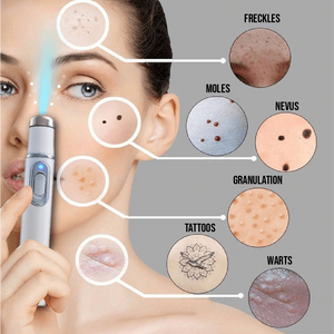 MEDICO™ Blue Light Skin Spot Remover